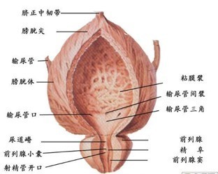 什么是前列腺炎？