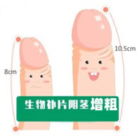 阴茎增粗术（脱细胞异体真皮组织植入）